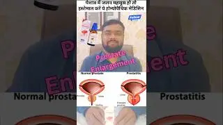 Best medicine for prostate enlargement #health #urineproblems #prostatetreatment #urinarysystem