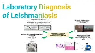 Laboratory Diagnosis of Leishmaniasis