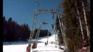 Wildalmlift