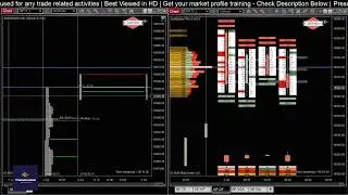 Ep. 131 | Live Market Profile + Order Flow Trade Analysis | #Nifty Auction Development