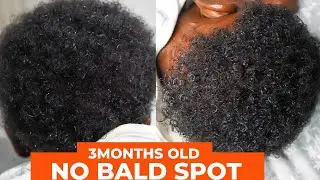 HOW TO PREVENT BALD SPOT ON BABY