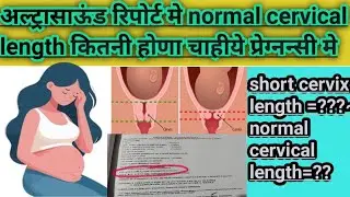 अल्ट्रासाऊंड रिपोर्ट मे cervical length (गर्भाशय ग्रीवा) नॉर्मल ये या अबनॉर्मल कैसे पता करे#ultrasou