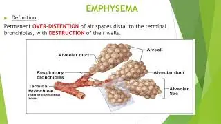 PATHOLOGY OF RESPIRATORY SYSTEM 3 2025 2026