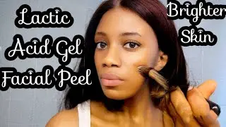 DIY Flawless Lactic Acid Facial Peel.