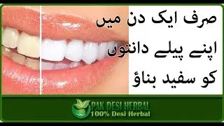 Teeth Whitening At Home In 3 Minutes || How To Whiten Your Yellow Teeth Naturally || Pak Desi Herbal
