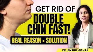 😳 Real Reasons Behind Double Chin | How To Get Rid of Double Chin? | Best Plastic Surgeon Tips