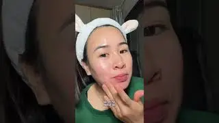 Giai Đoạn Tăng Sinh Da sẹo sau 5 ng&agrave;y d&ugrave;ng những th&agrave;nh phần g&igrave;&nbsp;để phục hồi da #Haophamspa #seoro 