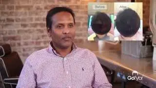Hair Loss Fibers | Gofybr product review - Miah