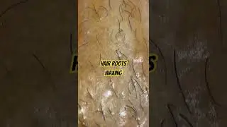 Depilando pela raiz, como &eacute;? 👀