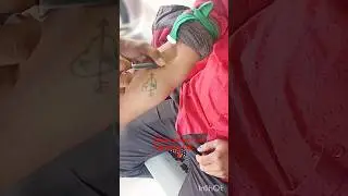 blood sample test Mp Widal CBC 💉🩸#shorts #ytshorts #youtubeshorts #trending #aarogya nursing home