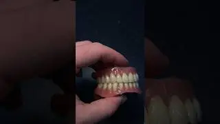 #dental #протезированиезубов #протез #allon4 #балка