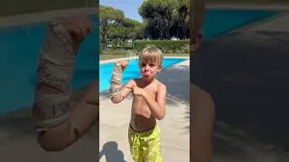 Swimming with a Plaster Cast .. Magic! 🤣🤣 #kids #shorts #brokenarm #swimming  #algarve