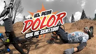 ¡El PEOR DOLOR que he sentido! | FACUNDO