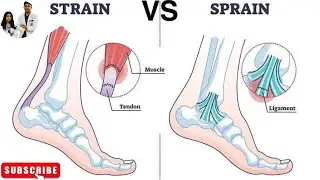 Strain vs. Sprain: What's the Difference?