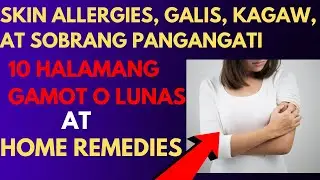 SKIN ALLERGIES, GALIS, KAGAW, AT SOBRANG PANGANGATI - 10 HALAMANG GAMOT, LUNAS AT HOME REMEDIES