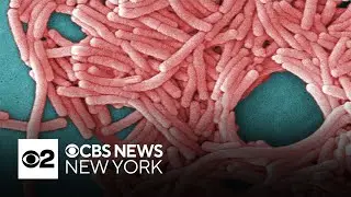 NYC Department of Health monitoring 2 Harlem buildings over Legionnaires' concerns