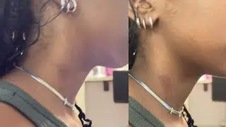 HICKEY PRANK ON MY MOM  !! *GONE WRONG*😬😬😬