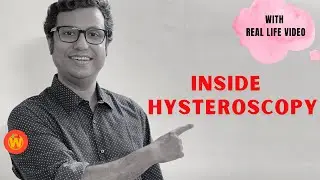 Hysteroscopy | All You Need to Know | A day in OT | Dr Manas Chakrabarti