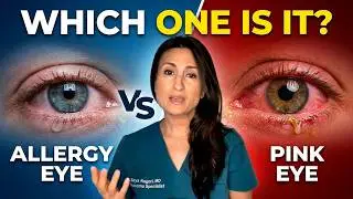 Eye Allergies vs Conjunctivitis | allergy eyes vs pink eye | allergic conjunctivitis |