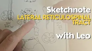 Sketchnote Lateral reticulospinal Tract