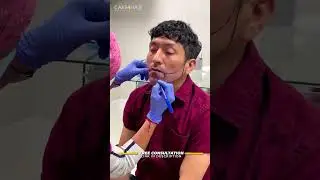 Beard Transplant: This is the procedure 😎 | Care4Hair