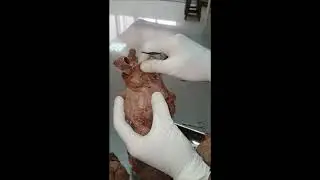 Features of Human Heart. Human Heart Anatomy