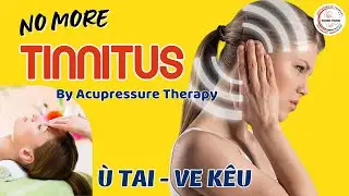Relieve Tinnitus with Acupressure Techniques - No Medication Needed! | Acupressure Therapy