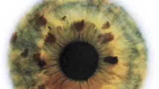 Distant System - Pupillary Response