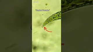 Closterium Algae Under Microscope (Mystery Vibrating Crystals)