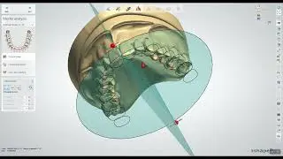 Creating Prostheses with Novaloc & MedentiLOC Library in 3Shape Dental System (2024)