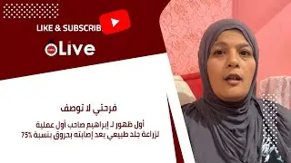 فرحتي لا توصف.. أول ظهور لـ إبراهيم صاحب أول عملية لزراعة جلد طبيعي بعد إصابته بحروق بنسبة 75%