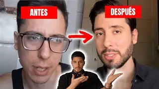 ASÍ SERÍA TU BARBA CON MINOXIDIL - Reaccionando a Gil Treviño (@gtvlogsmx)