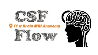 CSF flow anatomy - learn on a T1 weighted MRI of the brain