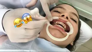COLOCANDO APARELHO