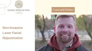 Fotona4D | Men | Non-Invasive Facial Rejuvenation | Esteem Medical Clinic | Dubai