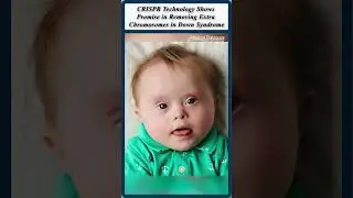 Технология CRISPR обещает удалить лишние хромосомы у людей с синдромом Дауна