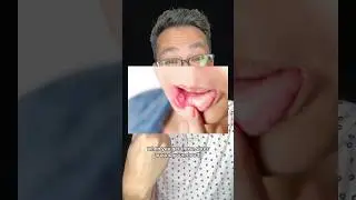 Three Tips if you're about to get Braces