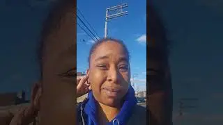 Sickle cell and avascular necrosis #sicklecellwarrior #scd #mamabear #sicklecellmatters