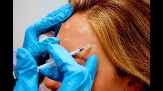 A Beginners Guide to Botox