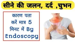 endoscopy | endoscopy cost | endoscopy test |endoscopic ultrasound | peptic ulcer