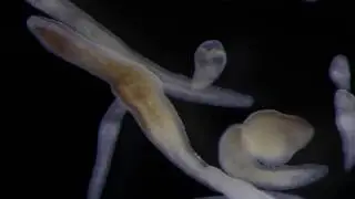 Nemertean hatchlings