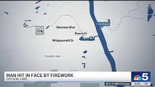 Firework mortar strikes suburban man in face, officials say
