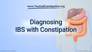 Diagnosing IBS with Constipation