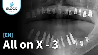 [EN dub / RU sub] AllonX - 3