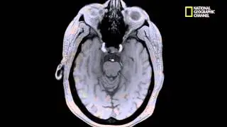 Breakthrough: Decoding the Brain