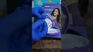 #aligners#invisiblealigners#beautifulsmile#teethstraightening#orthodontics#dentists#dentalstudents