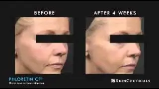 Skin Ceuticals @ Timeless Laser Rejuvenation Center