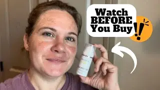 FULL REVIEW w/ Before & Afters Skinuva Brite Serum