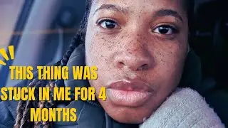 🥺 Prt#4 THE SHOCKING TRUTH ABOUT MY ULTRASOUND RESULTS.#canada#storytime #health