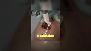 Could an AI Robot Replace Your Dentist? Here's What We Know!